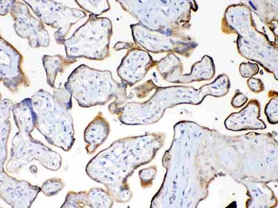 IHC - Anti-MUC1 Picoband Antibody ABO12811